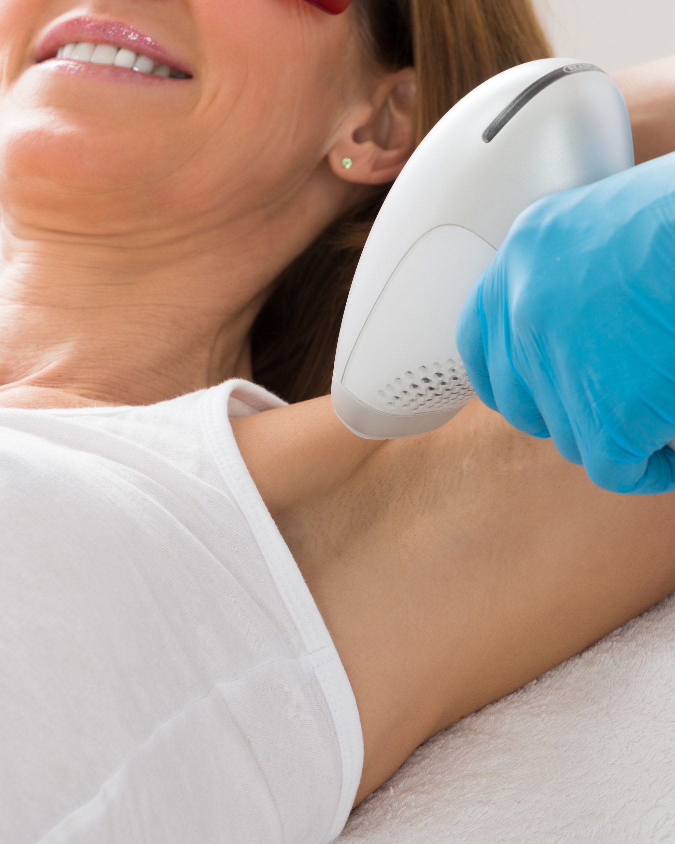 Laser Hair Removal Venice, FL: What to Expect During Your First Session
